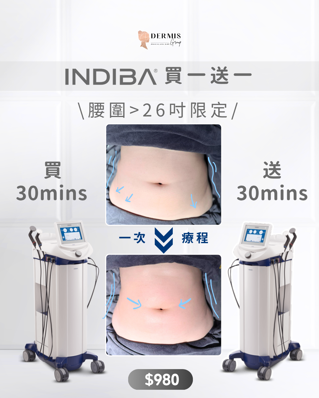 買一送一｜Indiba快閃優惠 | 身體療程