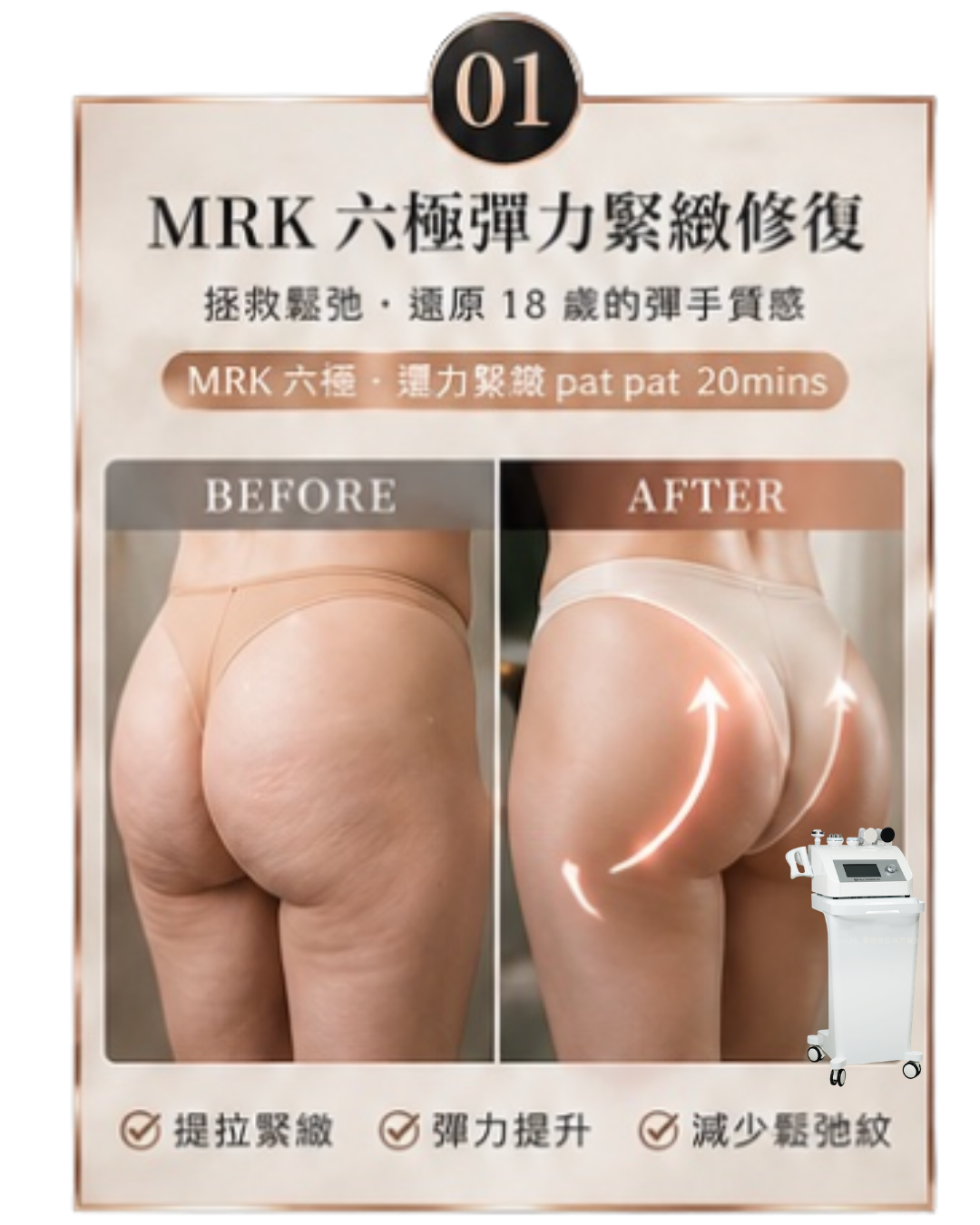 單項試做｜MRK 六極彈力緊緻修復