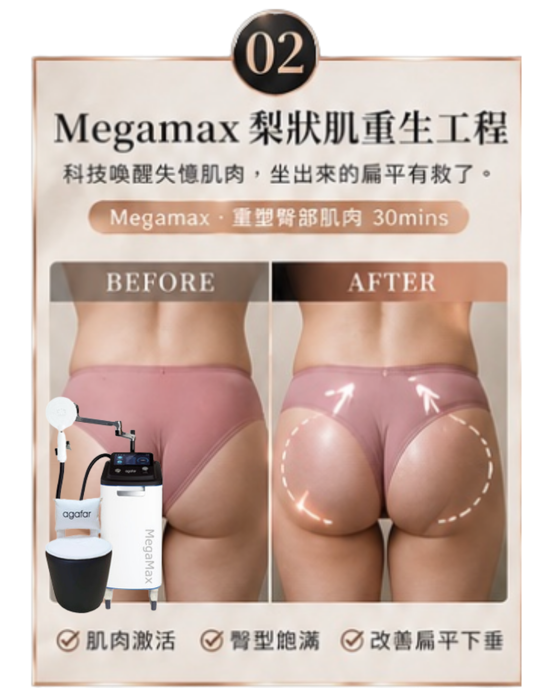 單項試做｜Megamax 梨狀肌重生工程