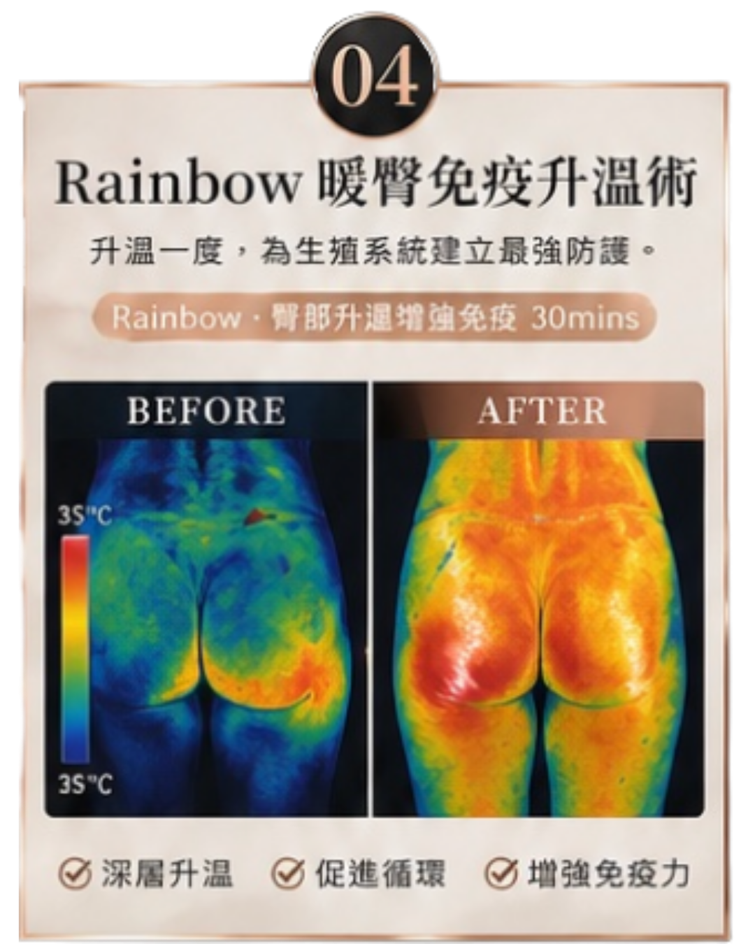單項試做｜Rainbow 暖臀免疫升溫術